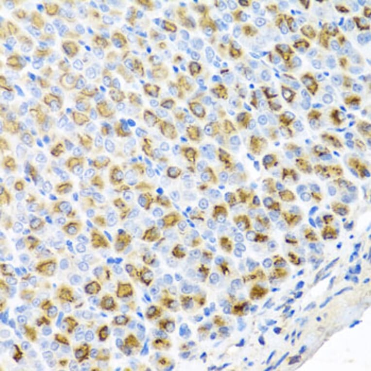 Immunohistochemistry - Anti-FECH Antibody (A16185) - Antibodies.com