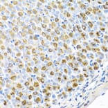 Immunohistochemistry - Anti-FECH Antibody (A16185) - Antibodies.com