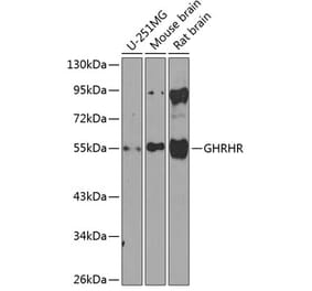 Western Blot - Anti-GHRHR Antibody (A16186) - Antibodies.com