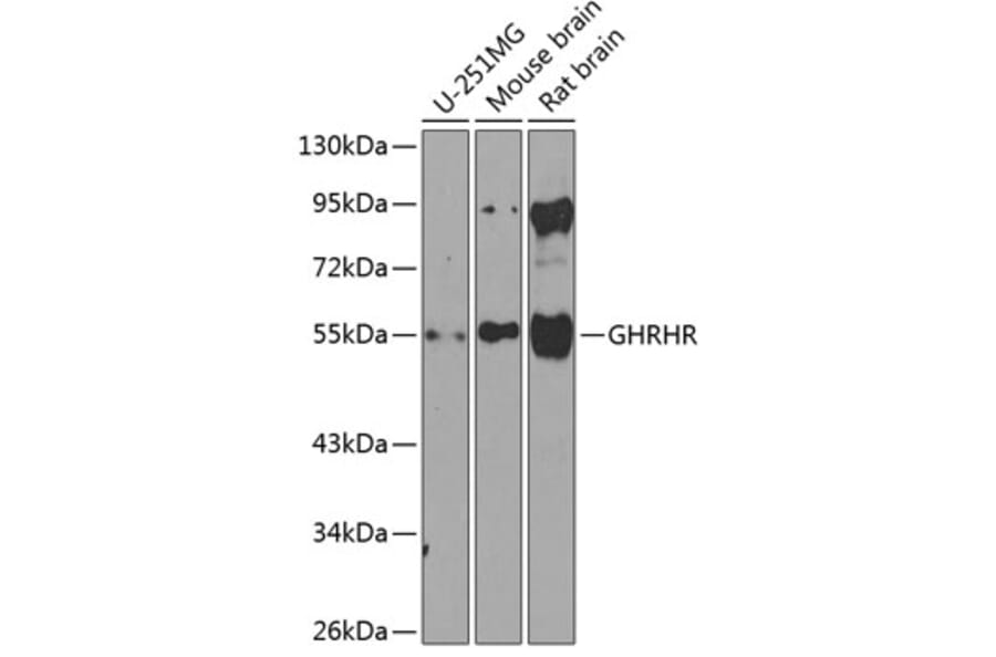 Western Blot - Anti-GHRHR Antibody (A16186) - Antibodies.com