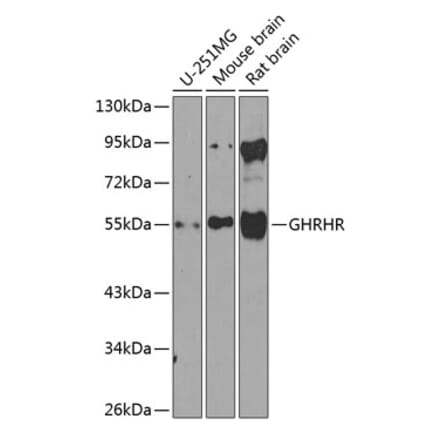 Western Blot - Anti-GHRHR Antibody (A16186) - Antibodies.com