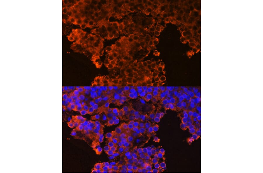 Immunofluorescence - Anti-GHRHR Antibody (A16186) - Antibodies.com