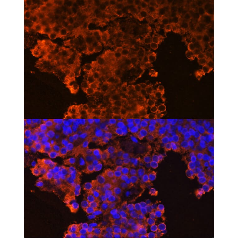 Immunofluorescence - Anti-GHRHR Antibody (A16186) - Antibodies.com