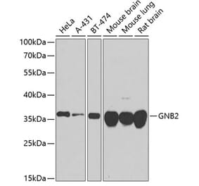Western Blot - Anti-GNB2 Antibody (A16187) - Antibodies.com