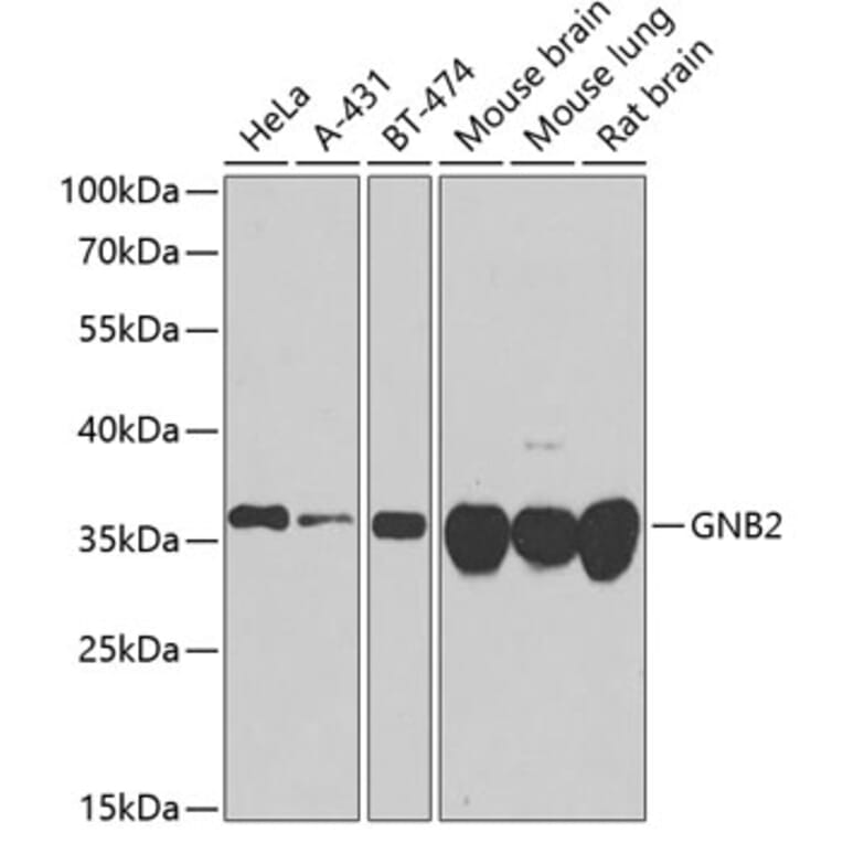 Western Blot - Anti-GNB2 Antibody (A16187) - Antibodies.com