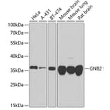Western Blot - Anti-GNB2 Antibody (A16187) - Antibodies.com