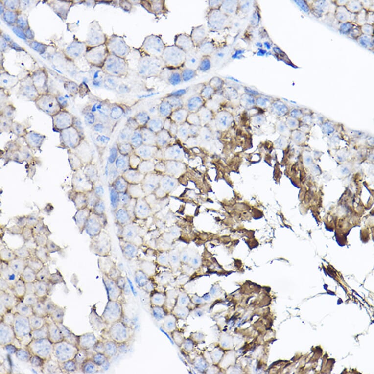 Immunohistochemistry - Anti-GNB2 Antibody (A16187) - Antibodies.com