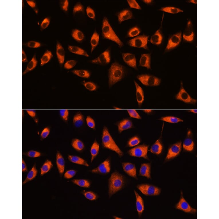 Immunofluorescence - Anti-GNB2 Antibody (A16187) - Antibodies.com