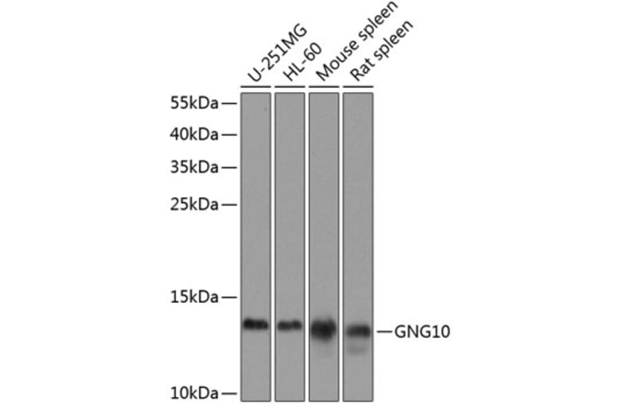 Western Blot - Anti-GNG10 Antibody (A16188) - Antibodies.com