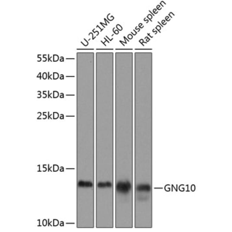 Western Blot - Anti-GNG10 Antibody (A16188) - Antibodies.com