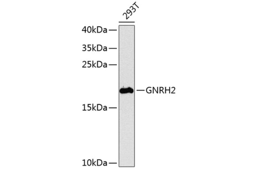 Western Blot - Anti-GNRH2 Antibody (A16189) - Antibodies.com