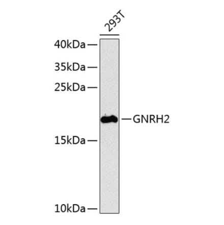Western Blot - Anti-GNRH2 Antibody (A16189) - Antibodies.com