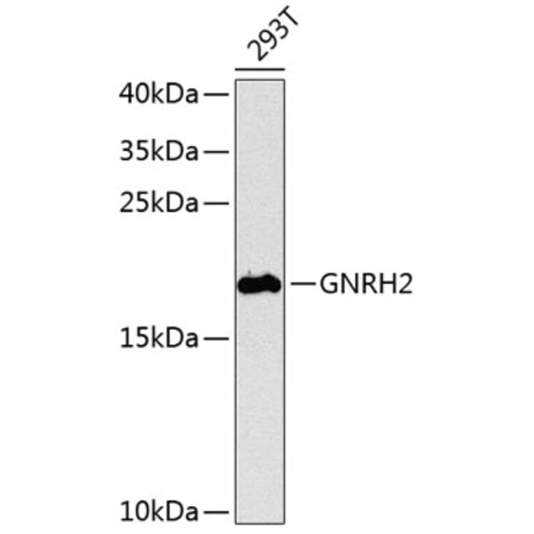 Western Blot - Anti-GNRH2 Antibody (A16189) - Antibodies.com