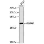 Western Blot - Anti-GNRH2 Antibody (A16189) - Antibodies.com