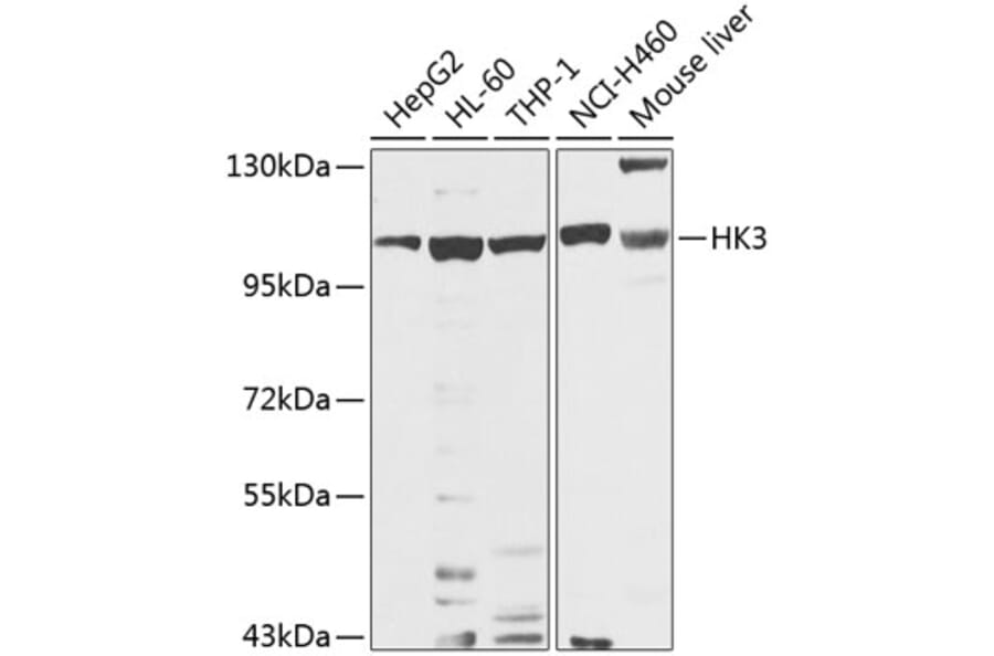 Western Blot - Anti-Hexokinase Type III/HK3 Antibody (A16190) - Antibodies.com