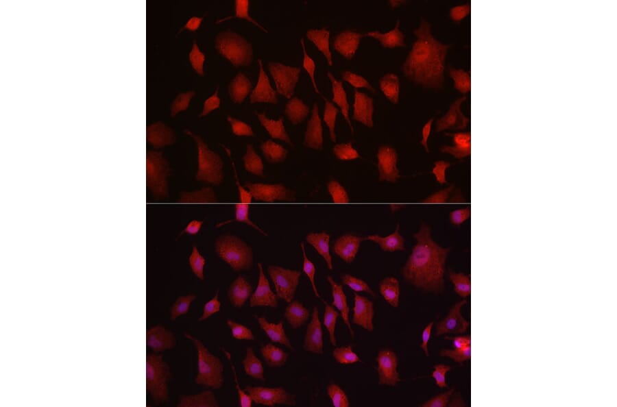 Immunofluorescence - Anti-Hexokinase Type III/HK3 Antibody (A16190) - Antibodies.com