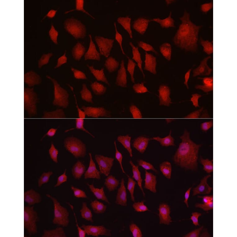 Immunofluorescence - Anti-Hexokinase Type III/HK3 Antibody (A16190) - Antibodies.com