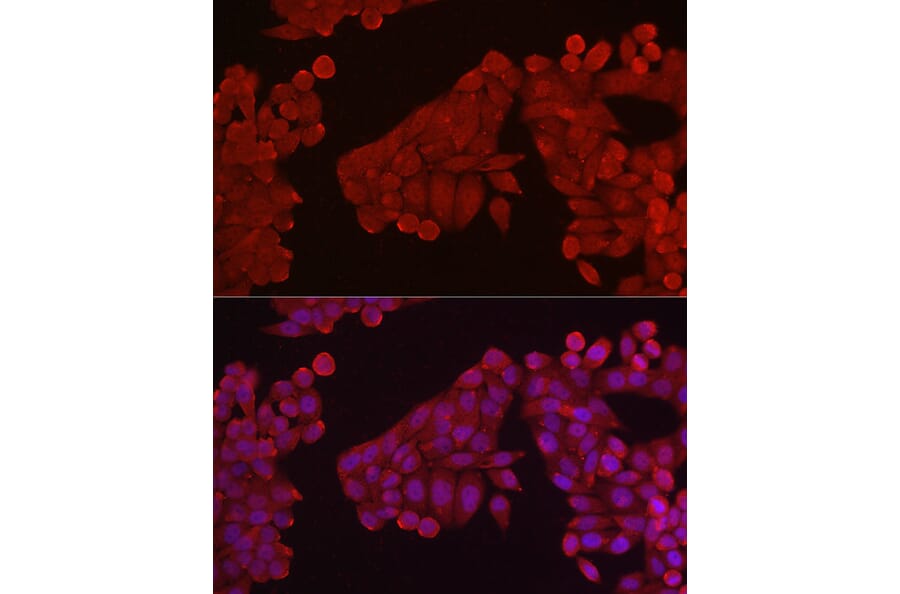 Immunofluorescence - Anti-Hexokinase Type III/HK3 Antibody (A16190) - Antibodies.com