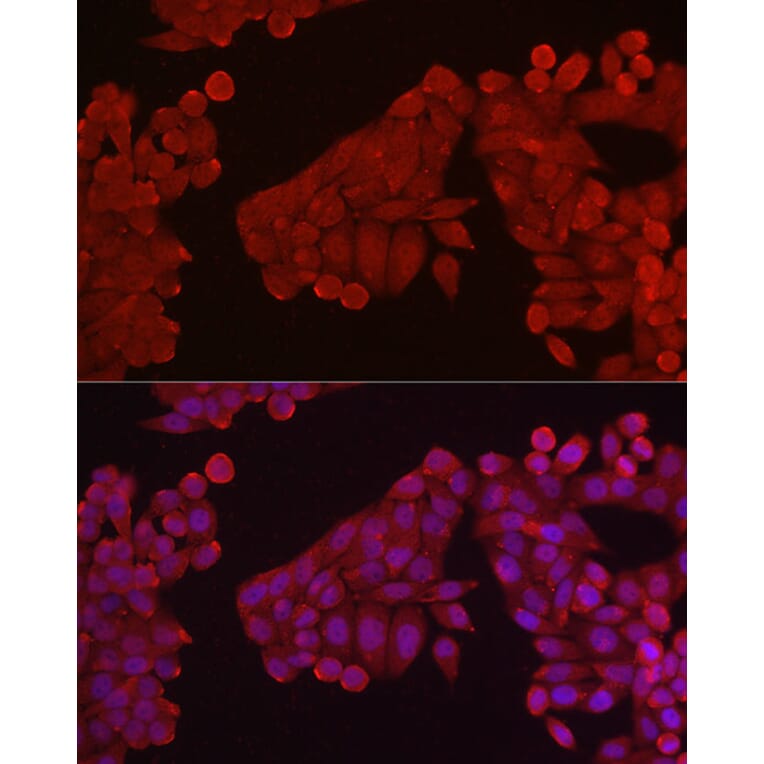 Immunofluorescence - Anti-Hexokinase Type III/HK3 Antibody (A16190) - Antibodies.com