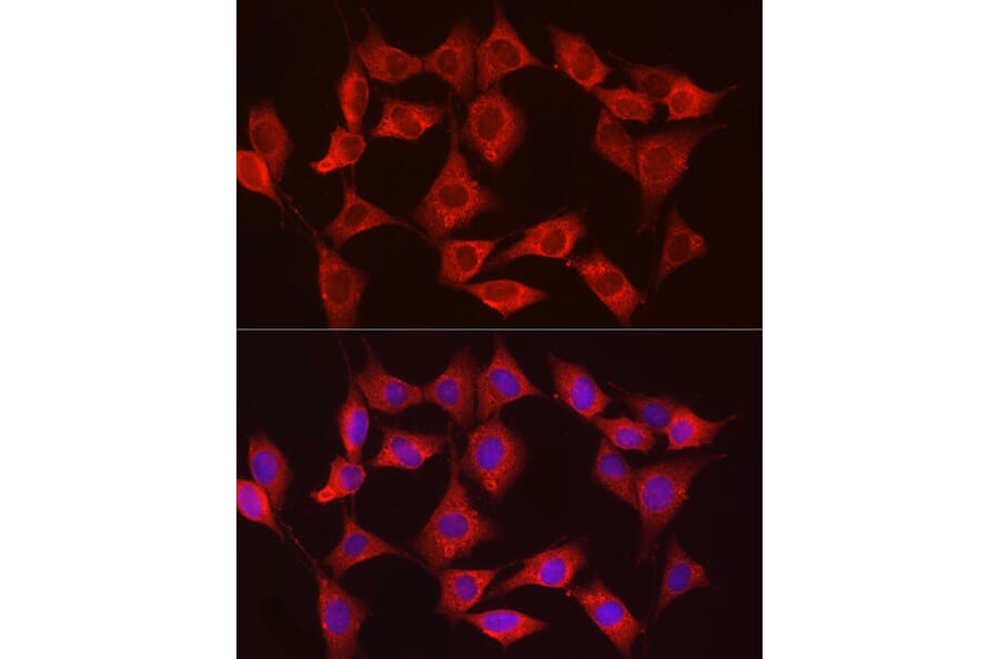 Immunofluorescence - Anti-Hexokinase Type III/HK3 Antibody (A16190) - Antibodies.com