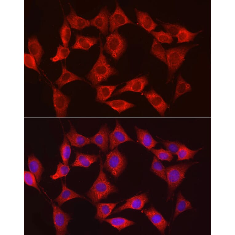 Immunofluorescence - Anti-Hexokinase Type III/HK3 Antibody (A16190) - Antibodies.com