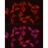 Immunofluorescence - Anti-Hexokinase Type III/HK3 Antibody (A16190) - Antibodies.com