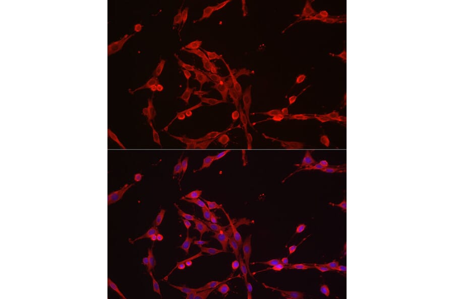 Immunofluorescence - Anti-Hexokinase Type III/HK3 Antibody (A16190) - Antibodies.com