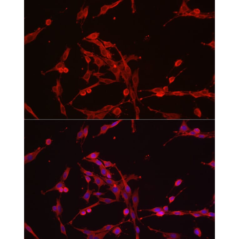 Immunofluorescence - Anti-Hexokinase Type III/HK3 Antibody (A16190) - Antibodies.com