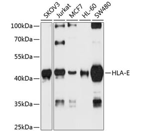 Western Blot - Anti-HLA E Antibody (A16191) - Antibodies.com