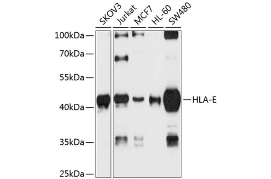 Western Blot - Anti-HLA E Antibody (A16191) - Antibodies.com