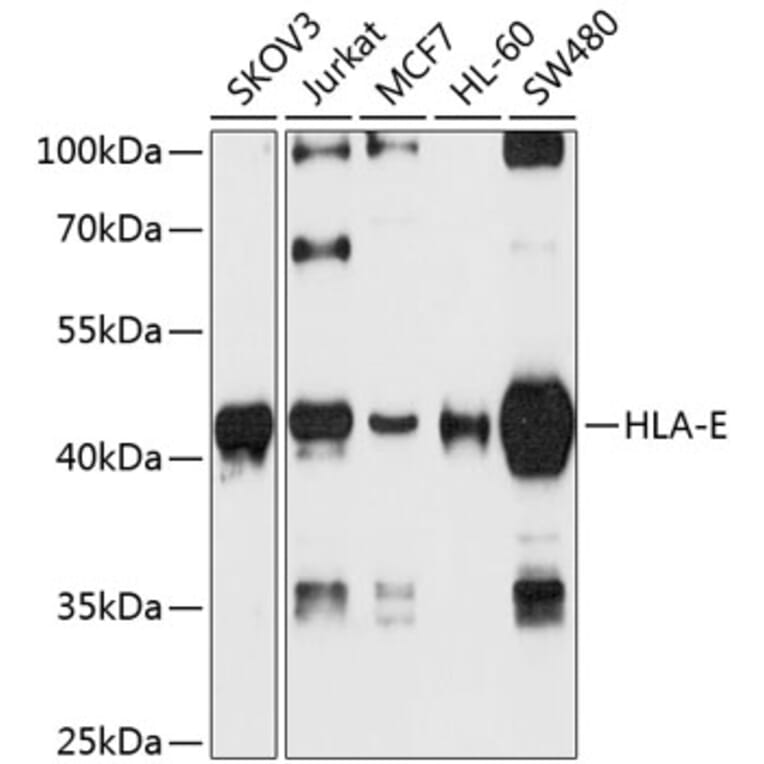 Western Blot - Anti-HLA E Antibody (A16191) - Antibodies.com