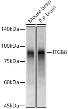 Western blot analysis of extracts of various cell lines, using Anti-ITGB8 Antibody (A8433) at 1:1,000 dilution.
Secondary antibody: Goat Anti-Rabbit IgG (H+L) (HRP) (AS014) at 1:10,000 dilution.
Lysates / proteins: 25µg per lane.
Blocking buffer: 3% non-fat dry milk in TBST.
Detection: ECL Basic Kit (RM00020).
Exposure time: 5s.