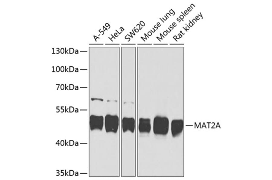 Western Blot - Anti-MAT2A Antibody (A16194) - Antibodies.com