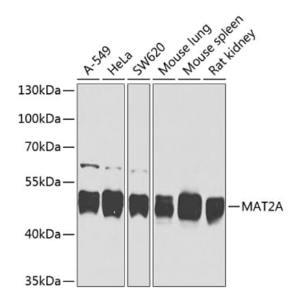 Western Blot - Anti-MAT2A Antibody (A16194) - Antibodies.com