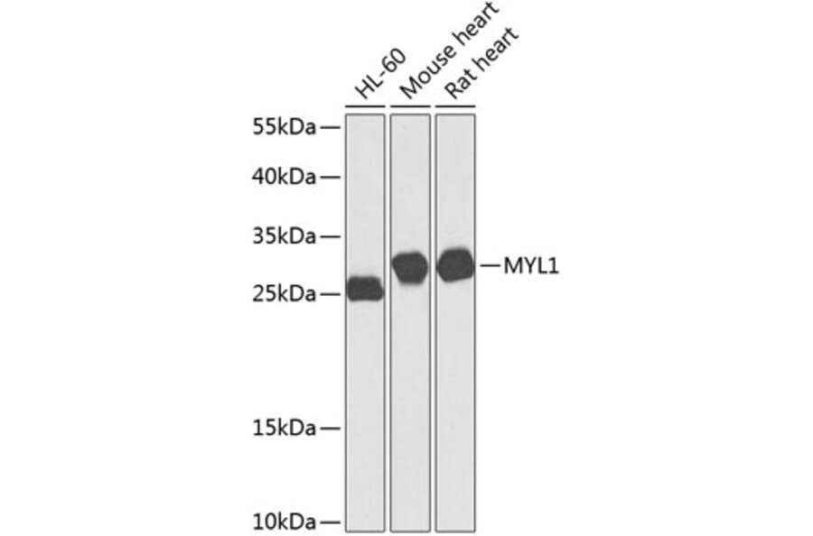 Western Blot - Anti-MYL1 Antibody (A16195) - Antibodies.com