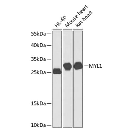 Western Blot - Anti-MYL1 Antibody (A16195) - Antibodies.com