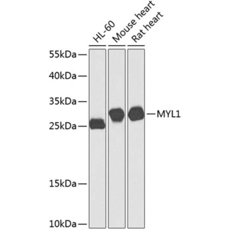 Western Blot - Anti-MYL1 Antibody (A16195) - Antibodies.com