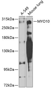 Western blot analysis of extracts of various cell lines, using Anti-MYO10 Antibody (A8439) at 1:1,000 dilution.
Secondary antibody: Goat Anti-Rabbit IgG (H+L) (HRP) (AS014) at 1:10,000 dilution.
Lysates / proteins: 25µg per lane.
Blocking buffer: 3% non-fat dry milk in TBST.
Detection: ECL Enhanced Kit (RM00021).
Exposure time: 90s.