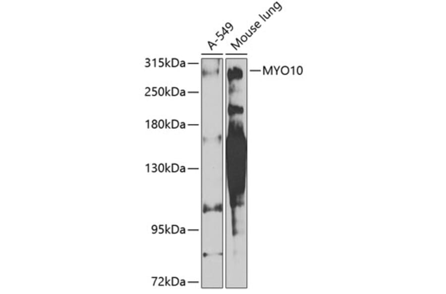 Western Blot - Anti-MYO10 Antibody (A16196) - Antibodies.com