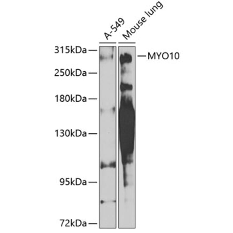 Western Blot - Anti-MYO10 Antibody (A16196) - Antibodies.com