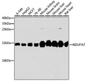 Western Blot - Anti-NDUFA7 Antibody (A16197) - Antibodies.com