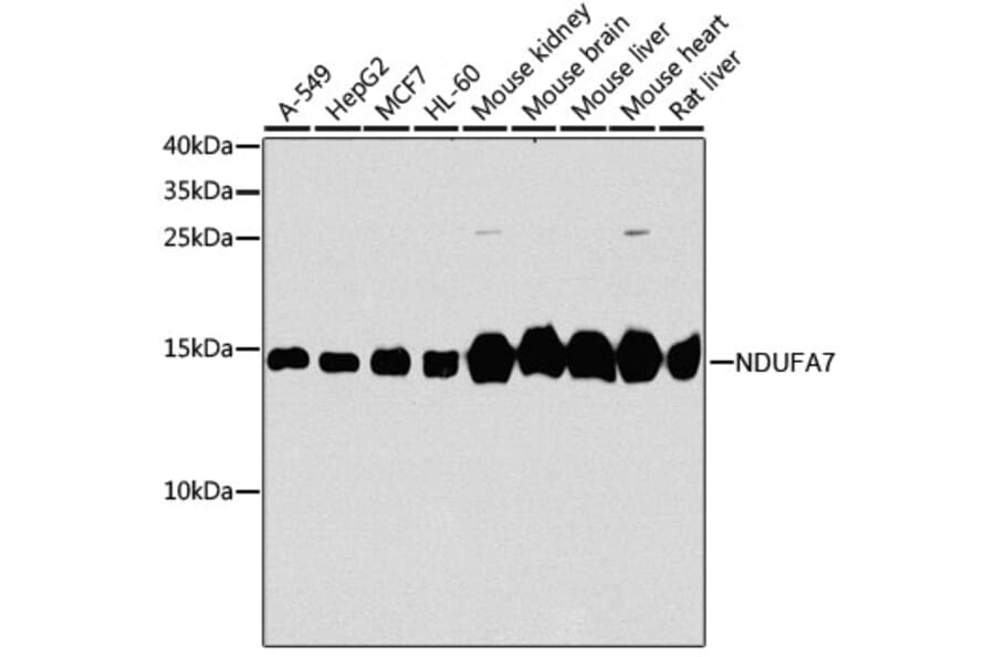 Western Blot - Anti-NDUFA7 Antibody (A16197) - Antibodies.com