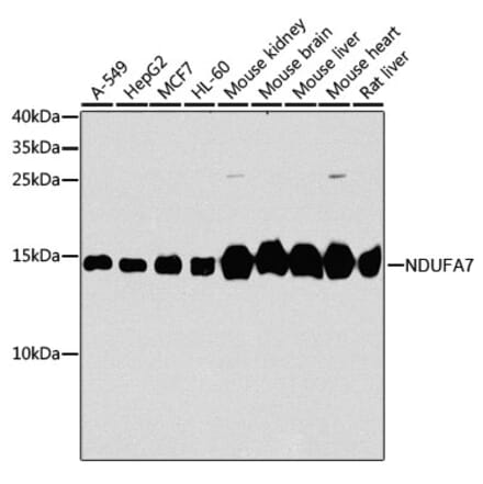 Western Blot - Anti-NDUFA7 Antibody (A16197) - Antibodies.com