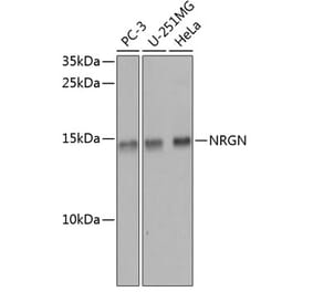 Western Blot - Anti-Neurogranin Antibody (A16198) - Antibodies.com