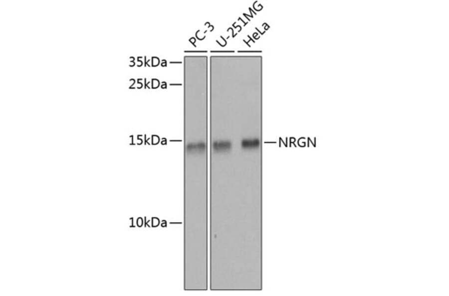 Western Blot - Anti-Neurogranin Antibody (A16198) - Antibodies.com