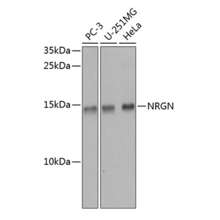 Western Blot - Anti-Neurogranin Antibody (A16198) - Antibodies.com