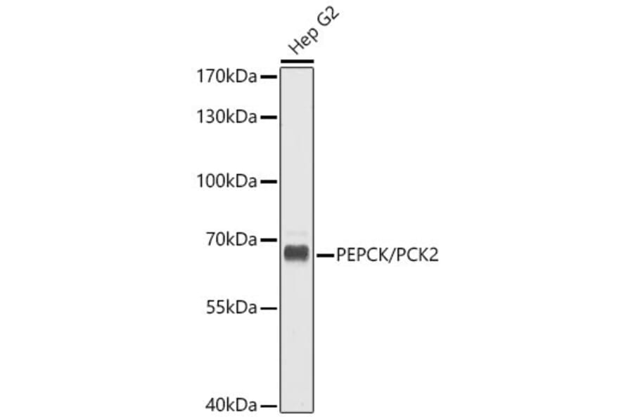 Western Blot - Anti-PCK2 Antibody (A16199) - Antibodies.com