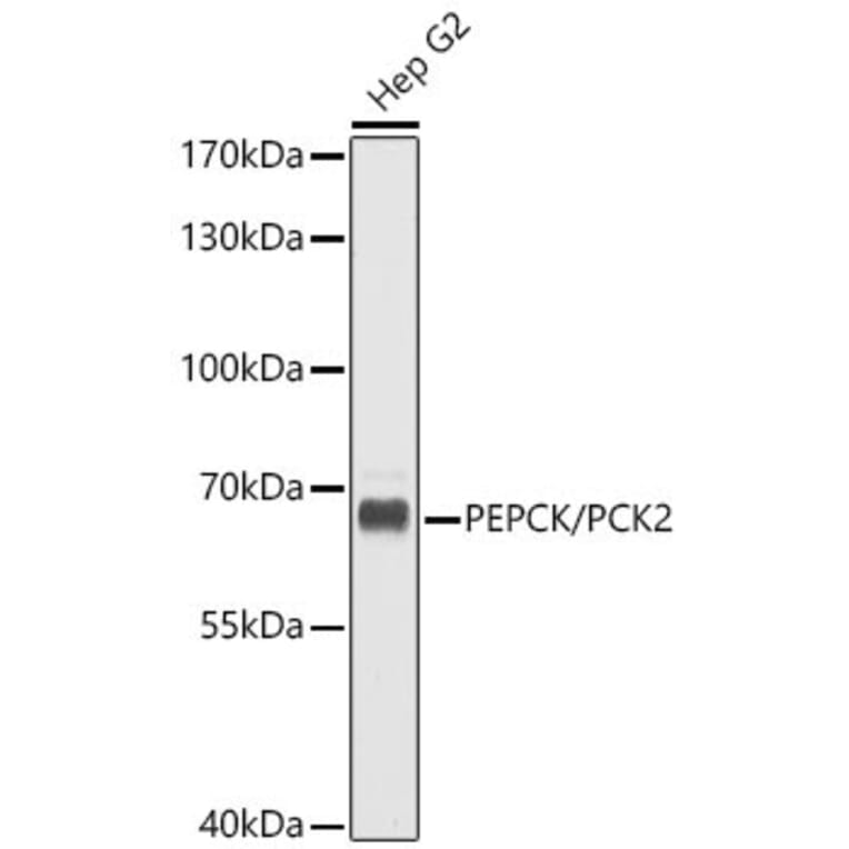 Western Blot - Anti-PCK2 Antibody (A16199) - Antibodies.com