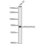 Western Blot - Anti-PCK2 Antibody (A16199) - Antibodies.com