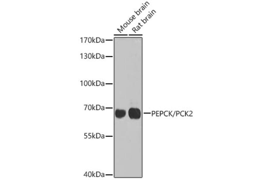 Western Blot - Anti-PCK2 Antibody (A16199) - Antibodies.com